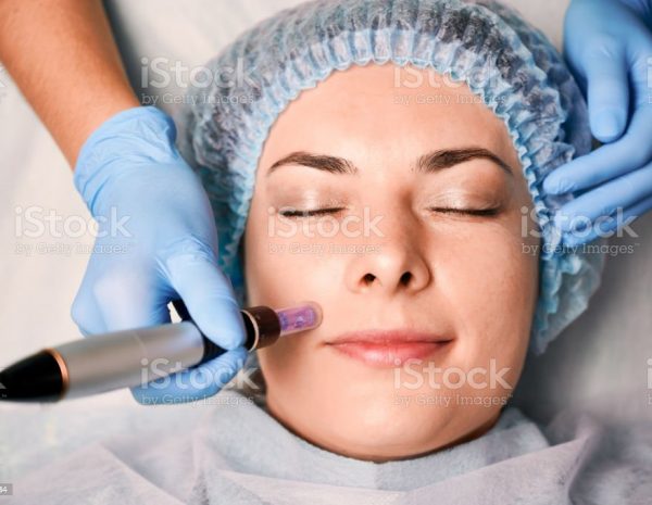 Close up of beautician hands in sterile gloves using dermapen during skincare procedure. Young woman receiving facial treatment in beauty salon. Concept of skincare and collagen induction therapy.